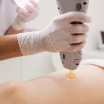 doctor-performing-laser-hair-removal-female-patient-skin-clinic_107420-65225