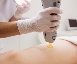 doctor-performing-laser-hair-removal-female-patient-skin-clinic_107420-65225