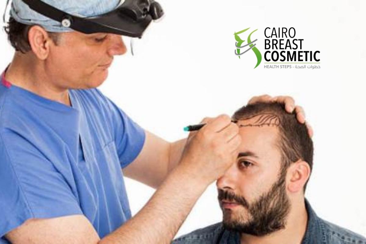 نصائح بعد زراعة الشعر